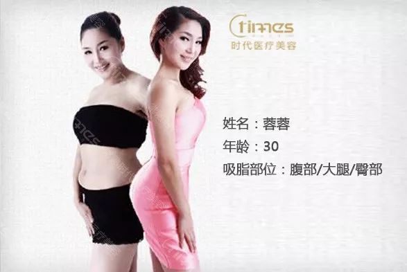 娜高丰胸，重塑女性魅力的秘密武器