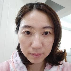 最好的除眼袋医院，专业、安全、效果的完美结合