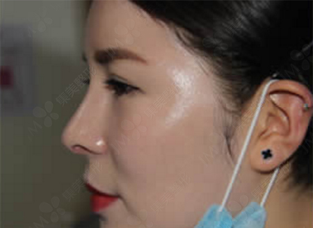 汕头整容，美丽蜕变的背后故事