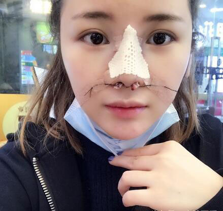垫鼻子医院，重塑自信的美丽殿堂
