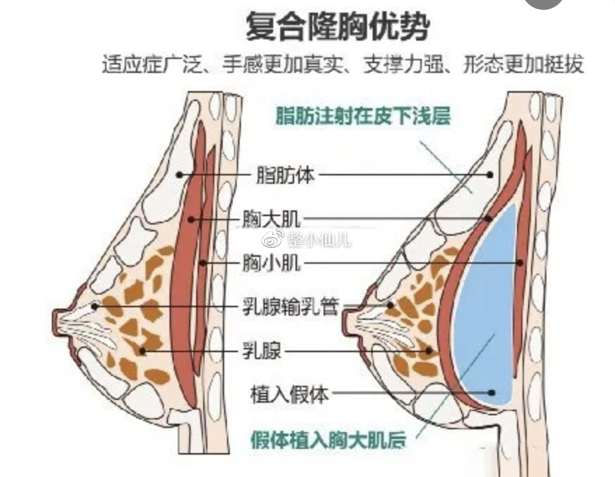丰胸机构哪里好的全面解析，打造完美曲线之选