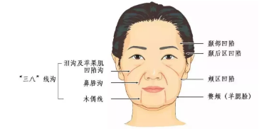 面部除皱，选择最佳医院的考量因素与指南