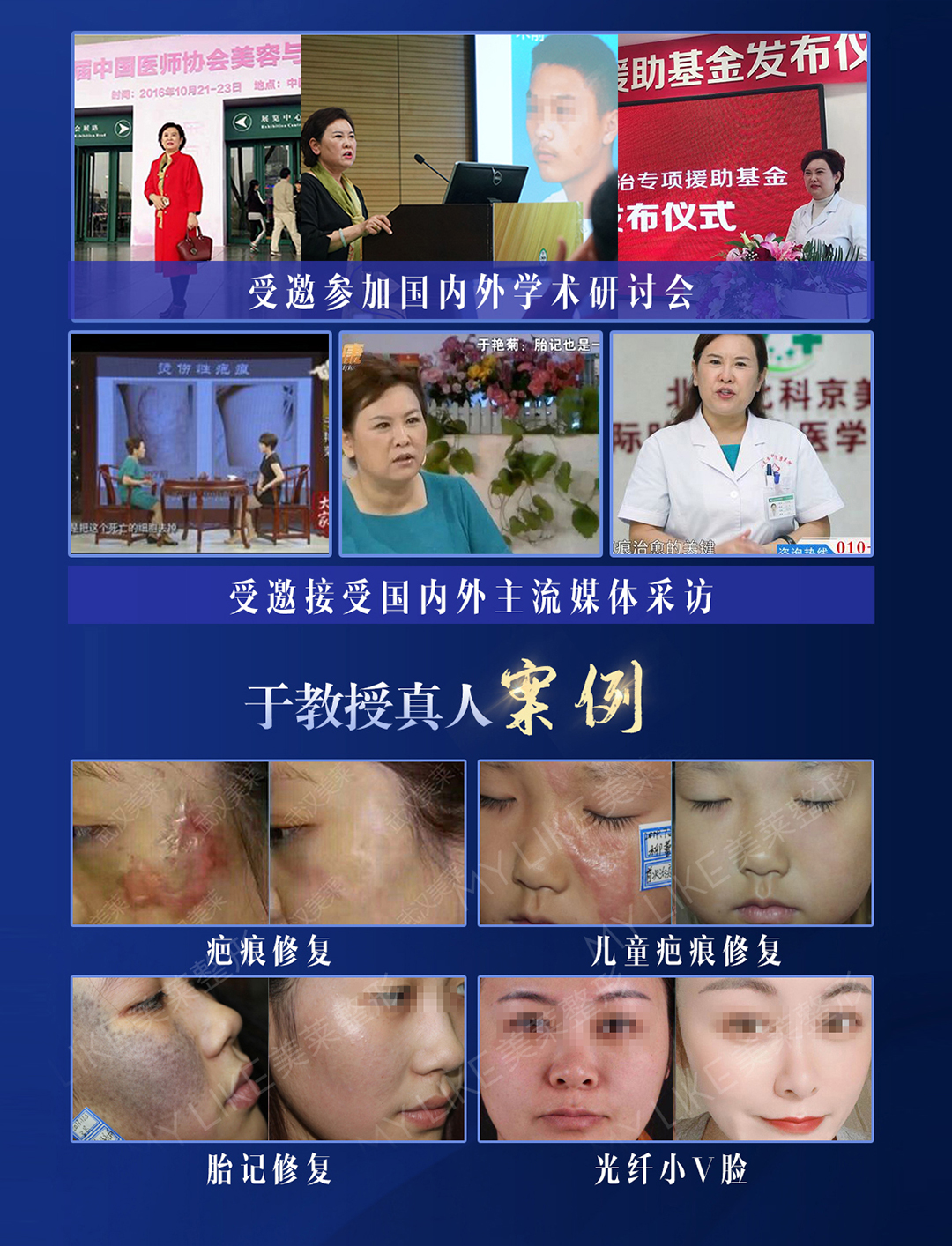 祛疤医院哪里效果最好，专业祛疤，重塑自信美