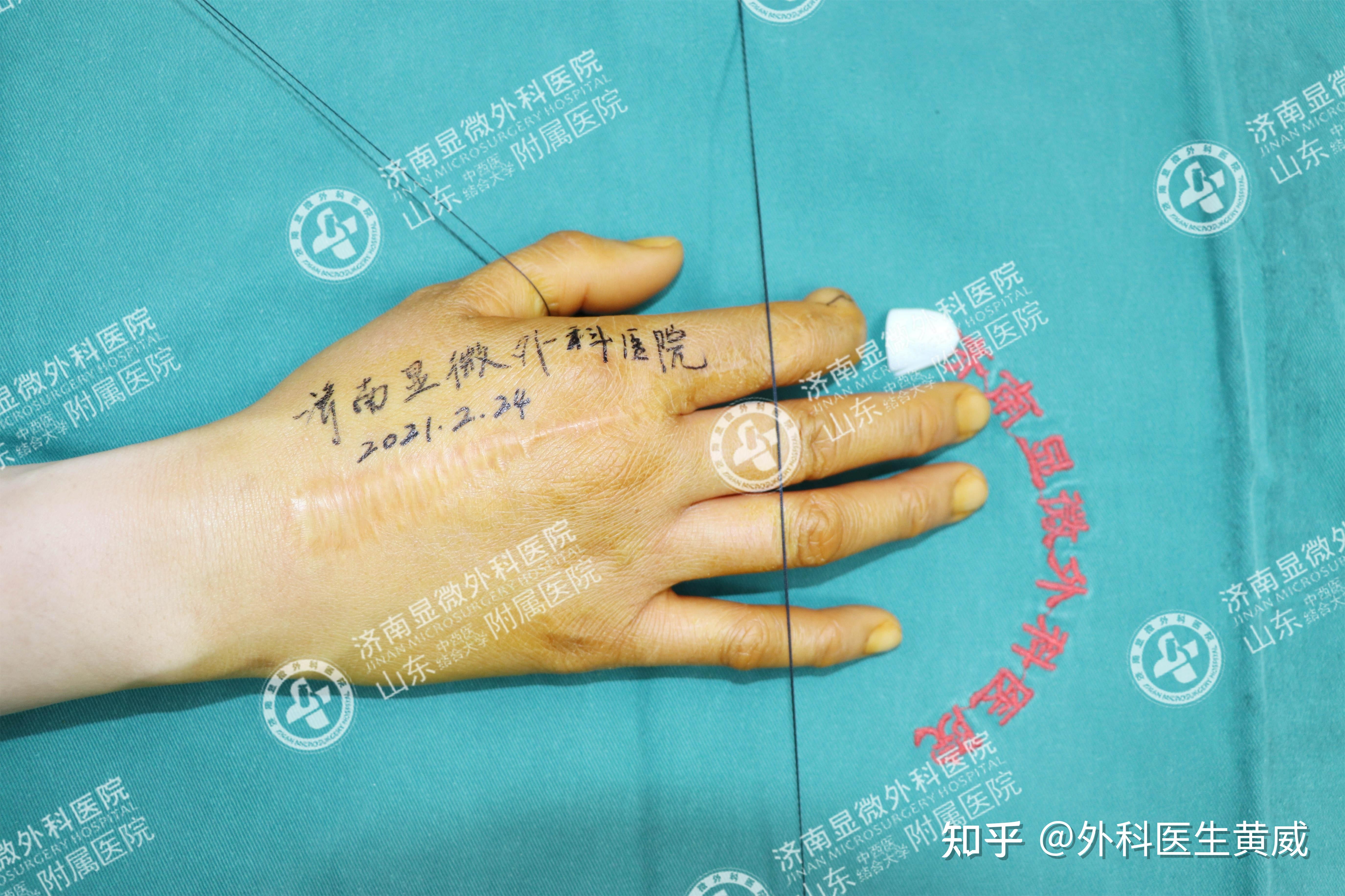 疤痕的治疗医院，专业修复，重塑美丽人生