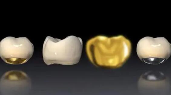 重庆烤瓷牙，技术与美学的完美结合