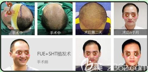 上海整形美容医院排名榜，深度解析与综合评估