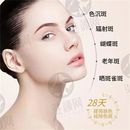 昆山祛斑，美丽容颜的秘诀