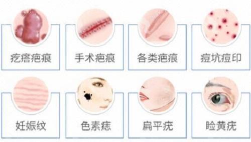探索最佳去伤疤医院，全面解析与推荐