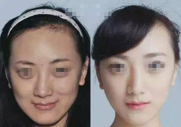探究整形整容价格，背后的因素与理解