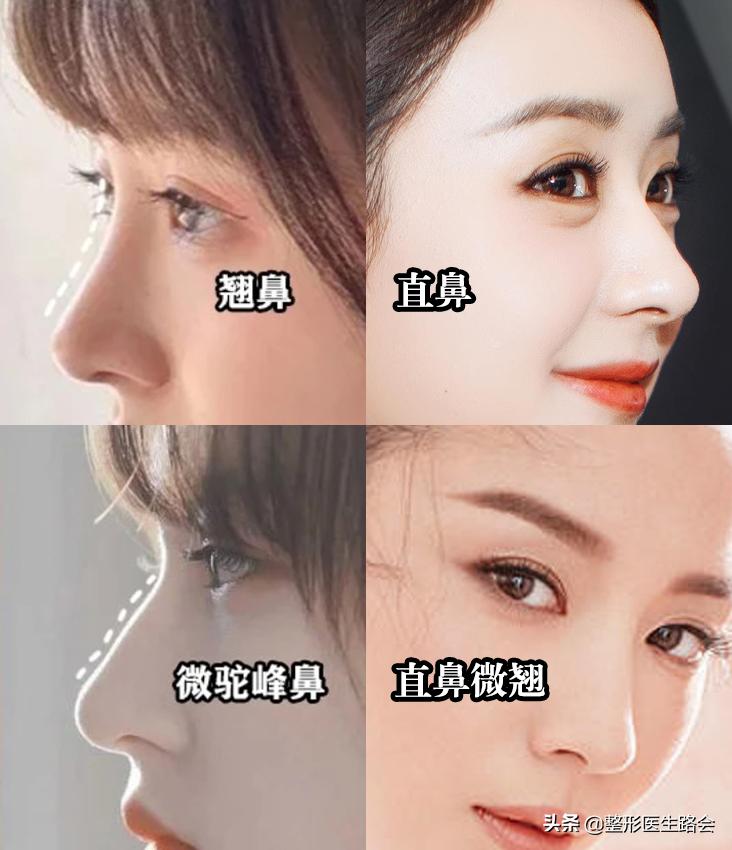 驼峰鼻价格，深入了解与全面解析