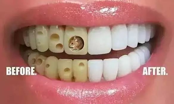 嘉兴洗牙，守护口腔健康的秘密武器