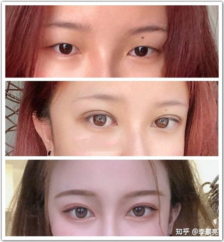 美丽转变