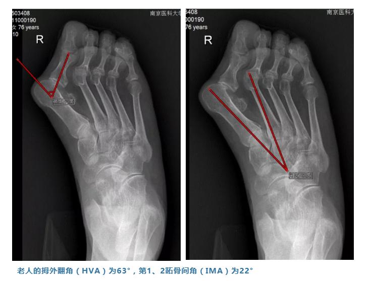 全国治大脚骨好的医院，专业团队与先进技术的融合
