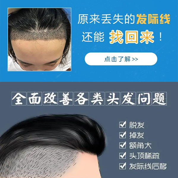 南京植发医院，专业植发，重塑自信风采
