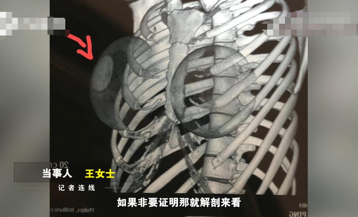 丰胸医院哪里好的全面解析与推荐