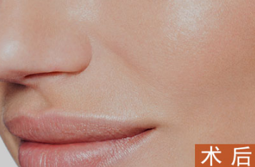 彩光祛痘价格，解析现代美容新选择
