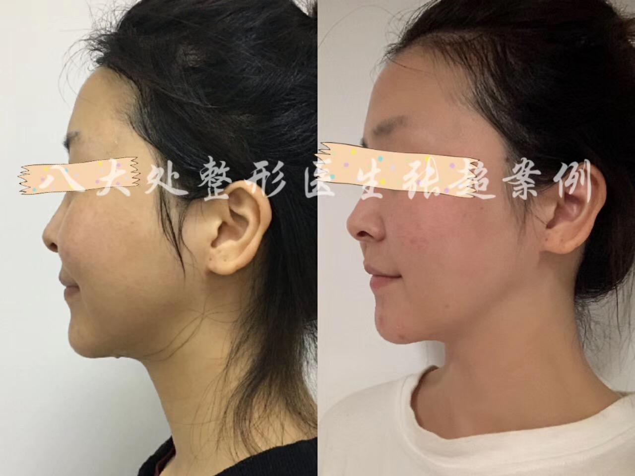 第1501页