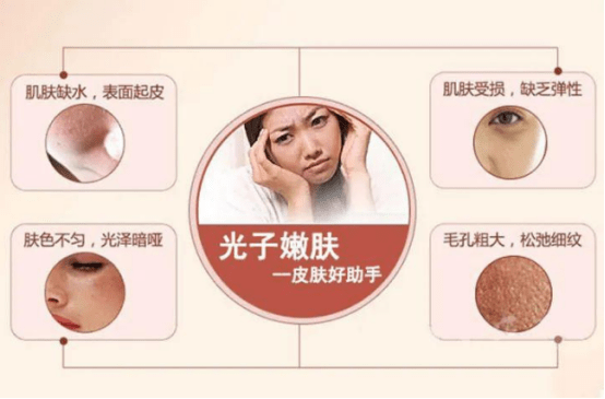 哪里做光子嫩肤好，专业美容机构的选择与考量