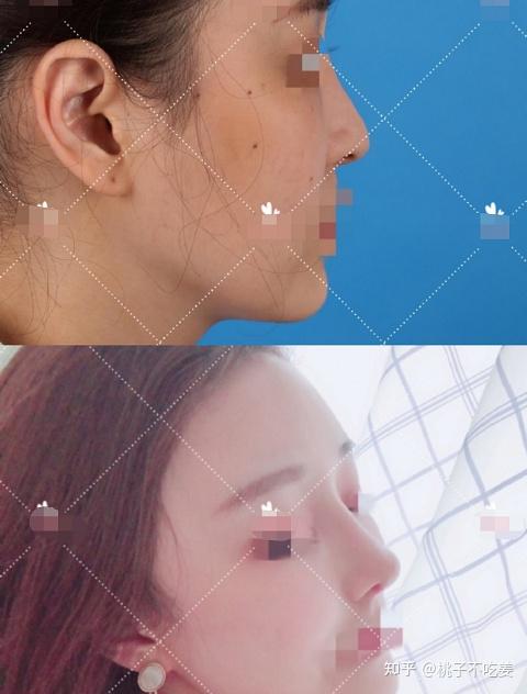 重塑美丽