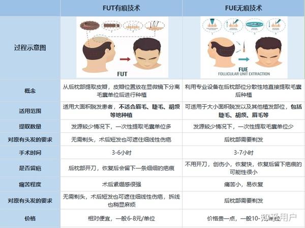 长沙植发要多少钱？全面解析植发费用构成因素