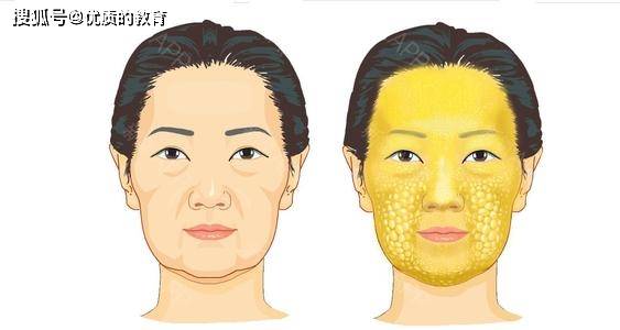 北京除皱哪家强？深度解析北京除皱美容机构