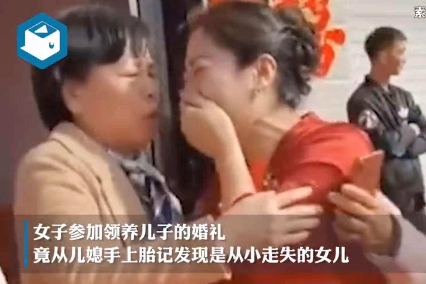 苏州祛胎记，专业治疗，重塑美丽新人生