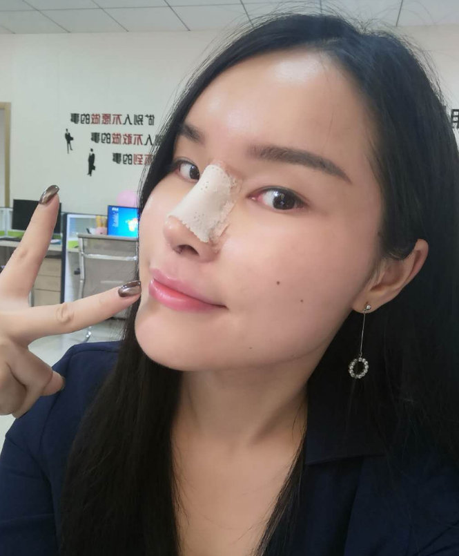 隆鼻手术，寻找专业的好医生
